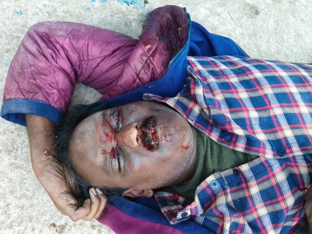 గుర్తు తెలియని వ్యక్తి మృతదేహం లభ్యం